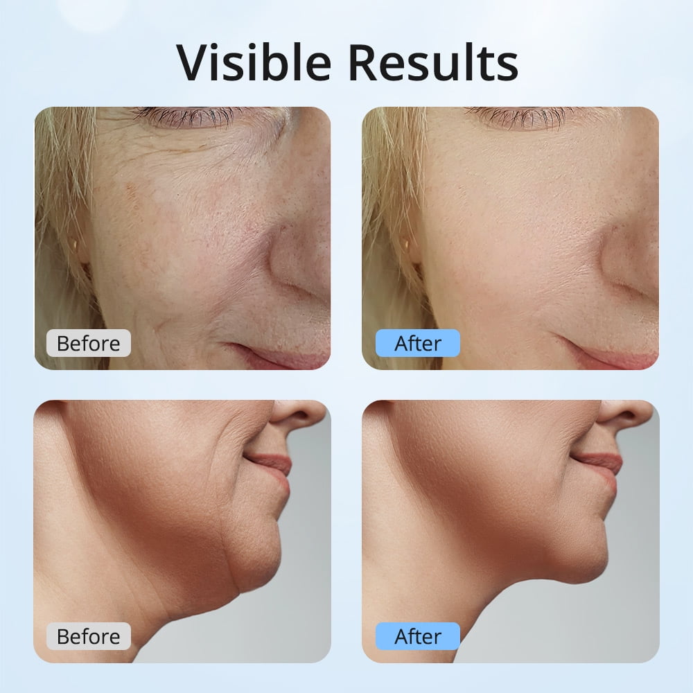 LumiLift Pro TM - Instant Glow & Lift